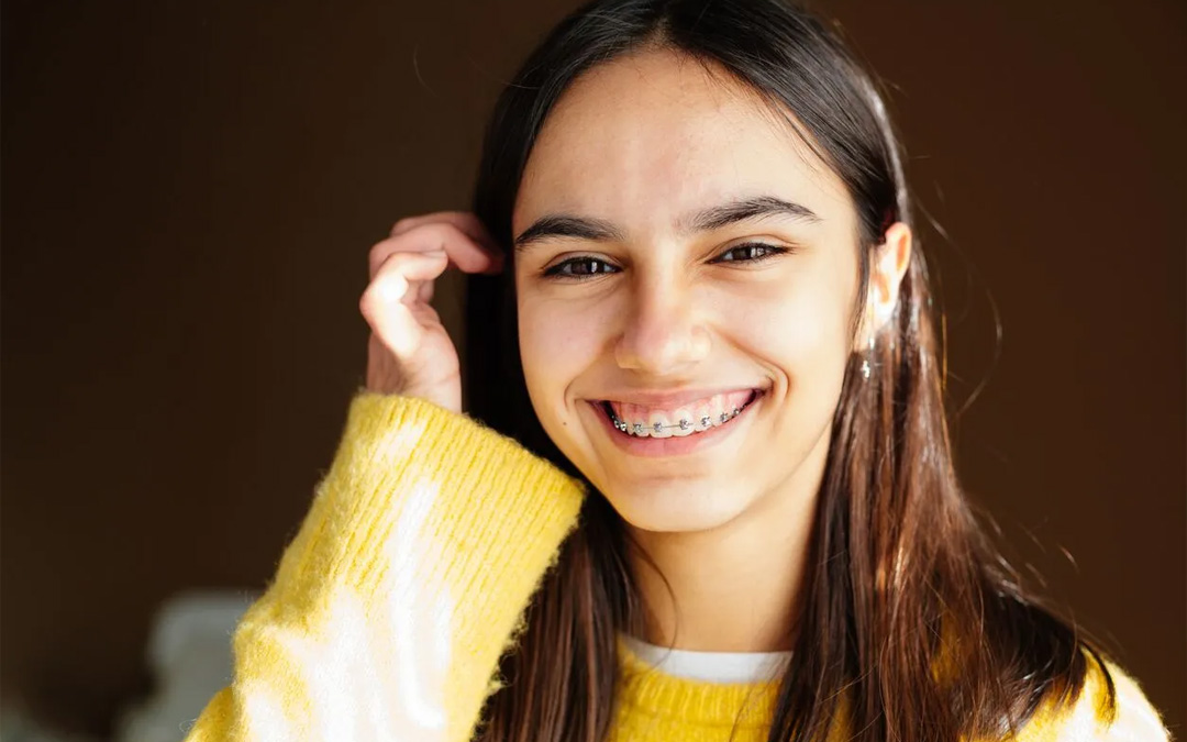 Adolescenti: durata di un trattamento ortodontico e alimentazione